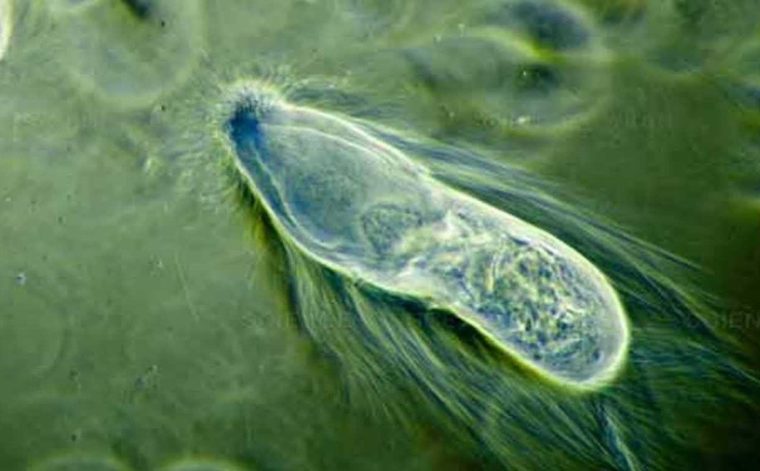 Filum Protozoa